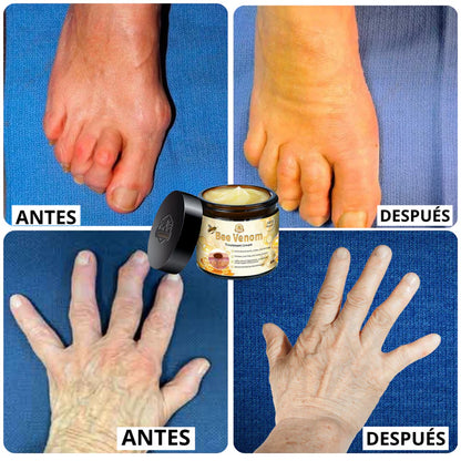 Bee Venom Bswell - Crema Para Dolores con Veneno de Abeja